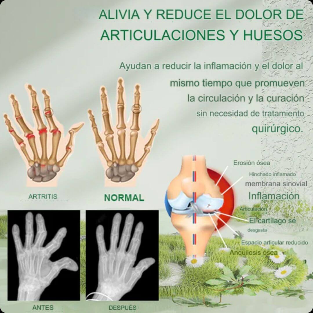 Beevana- Crema para terapia de huesos y articulaciones HOY 2X1 🎁