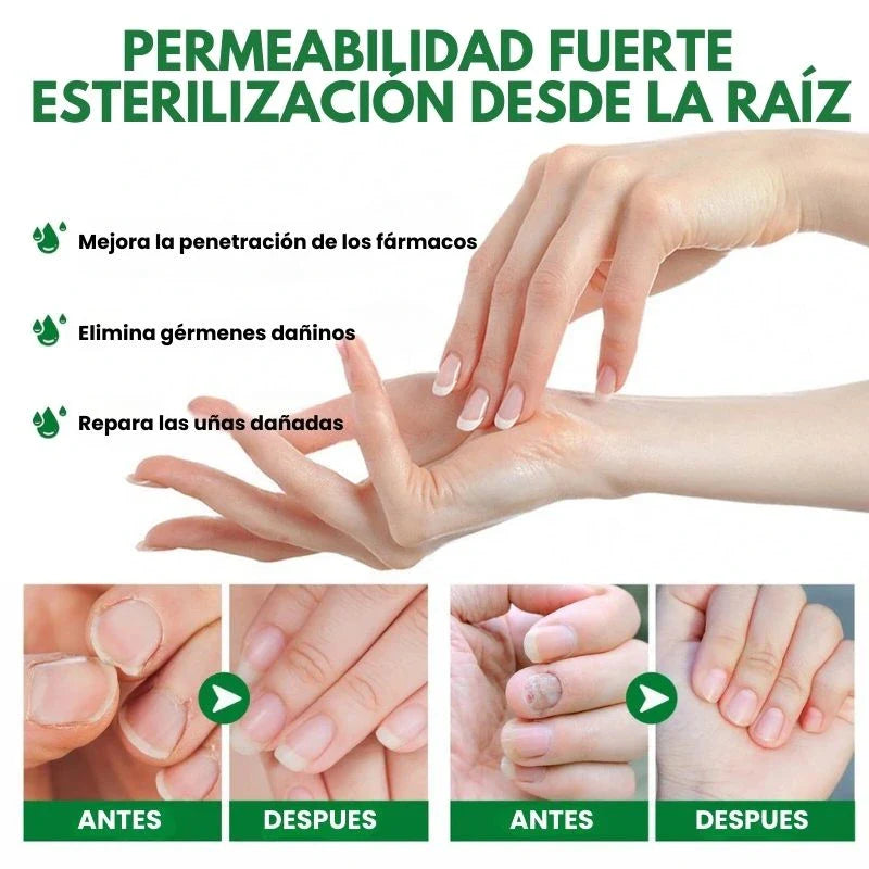 ClearNails® - Uñas Saludables en 7 Días