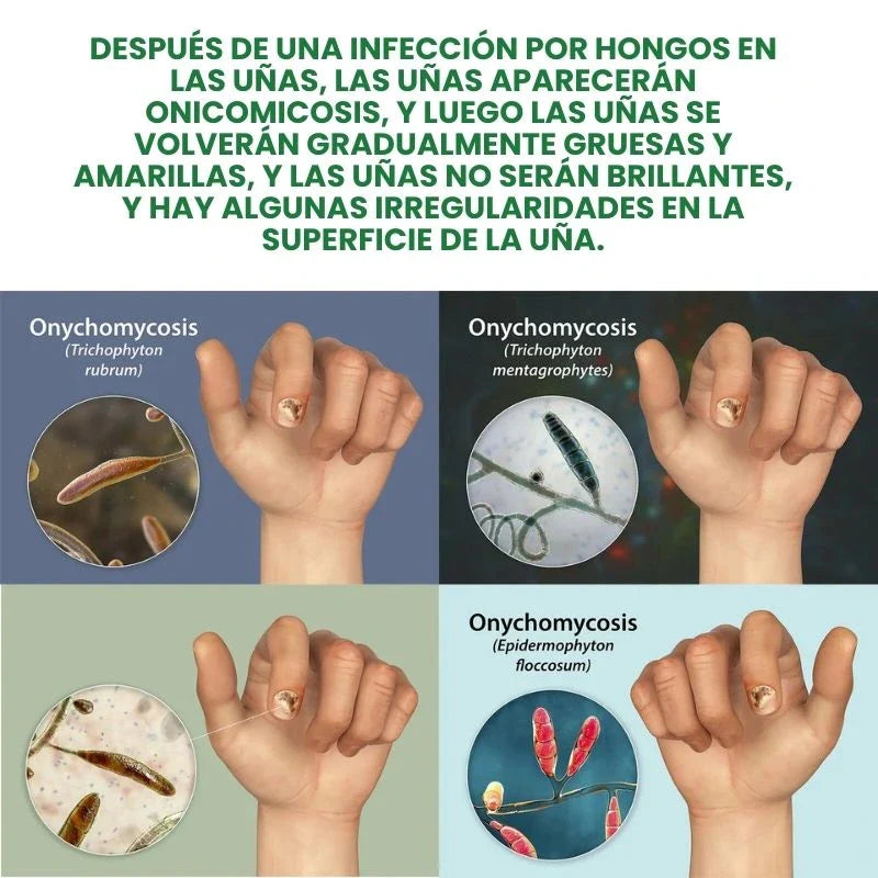 ClearNails® - Uñas Saludables en 7 Días