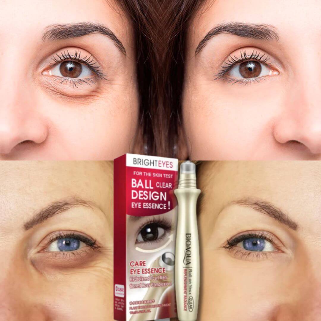 EyeRevive™ - ¡Elimina ojeras y arrugas en 7 días! 🎁 Hoy 2x1
