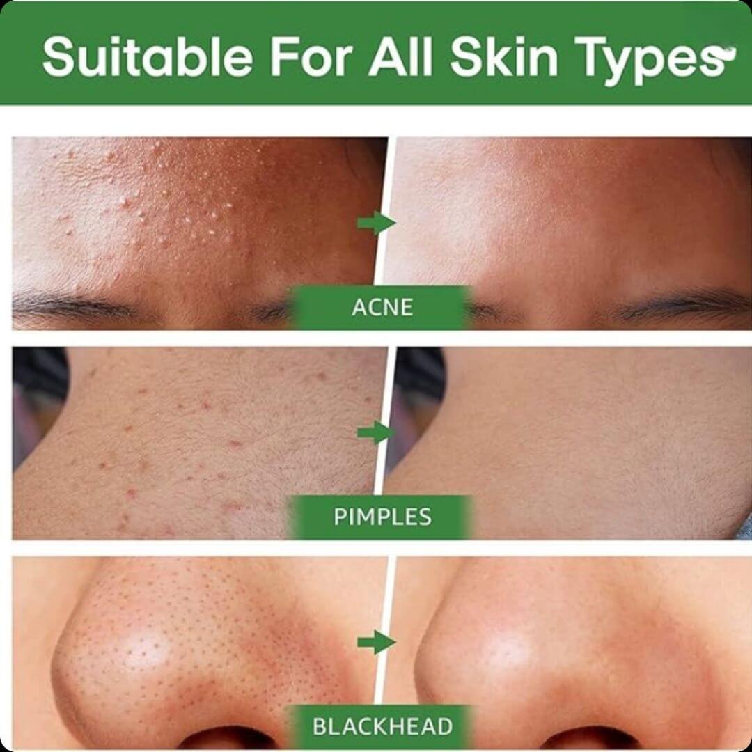 Crystal Skin™ MASCARILLA ENRIQUECIDA CON TÉ VERDE