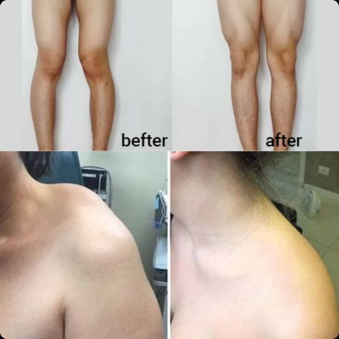 Beevana- Crema para terapia de huesos y articulaciones HOY 2X1 🎁