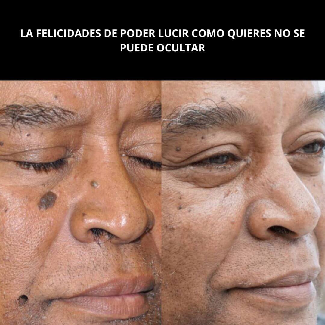 GlowAway™️ - La Solución para una Piel Perfecta al Instante