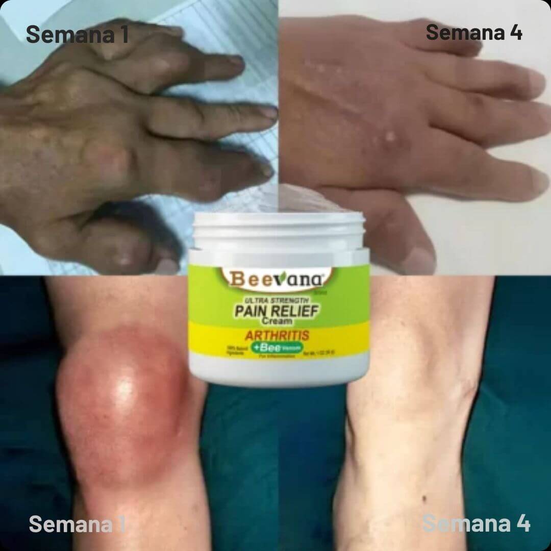 Beevana- Crema para terapia de huesos y articulaciones HOY 2X1 🎁