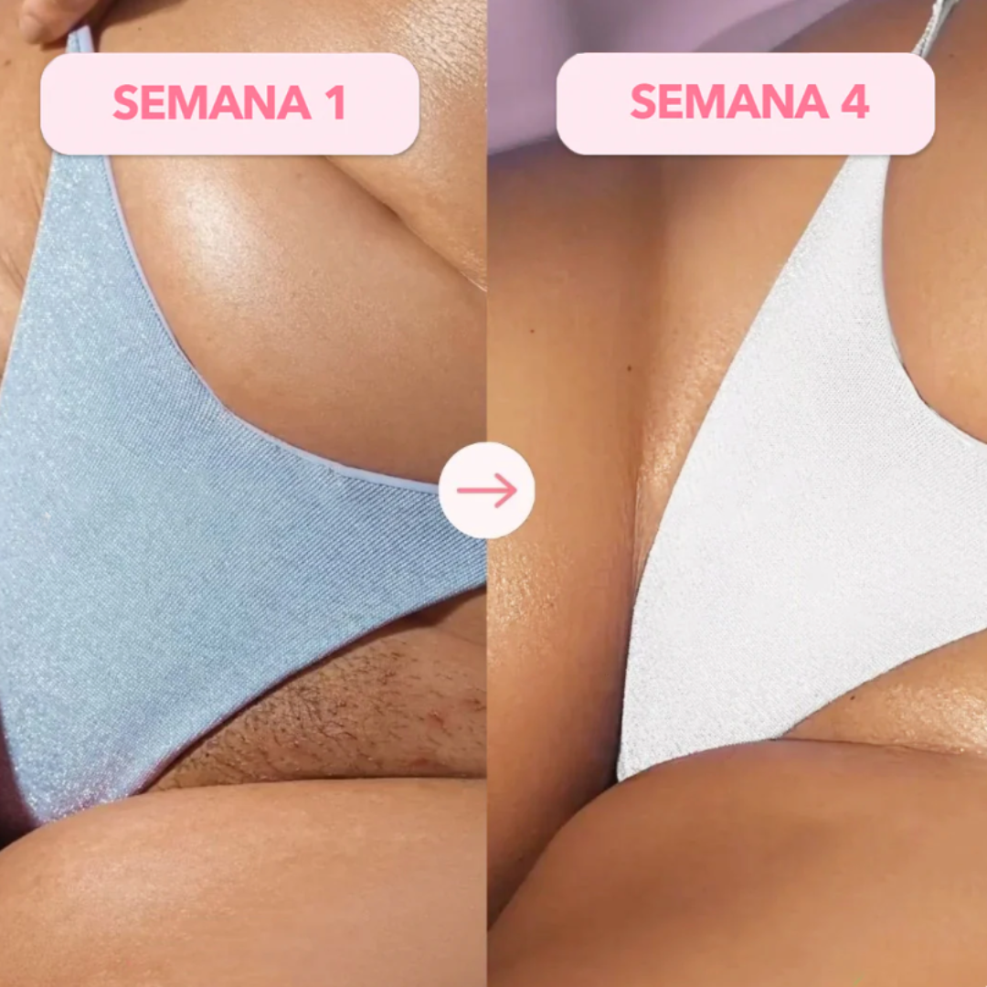 Depiladora Láser IPL Permanente