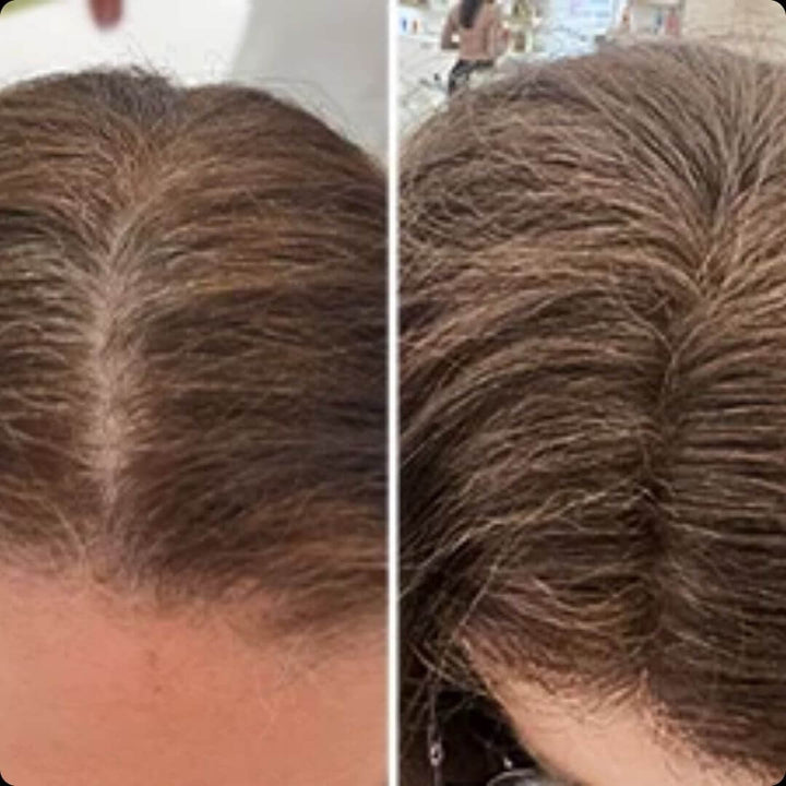 MagicHair- El secreto para rejuvenecer en 5 minutos