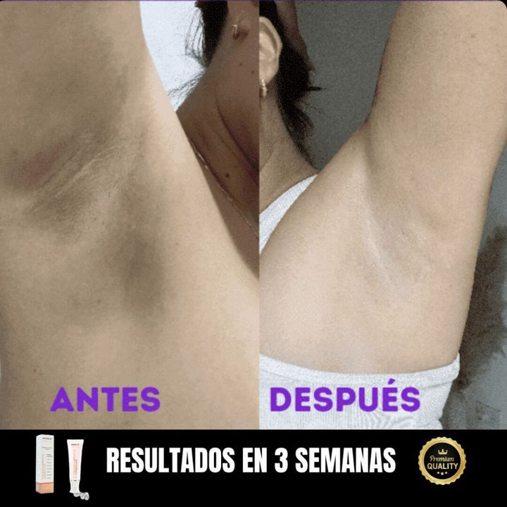 SkinGlow™ - Desmanchador Potente natural con Registro Invima