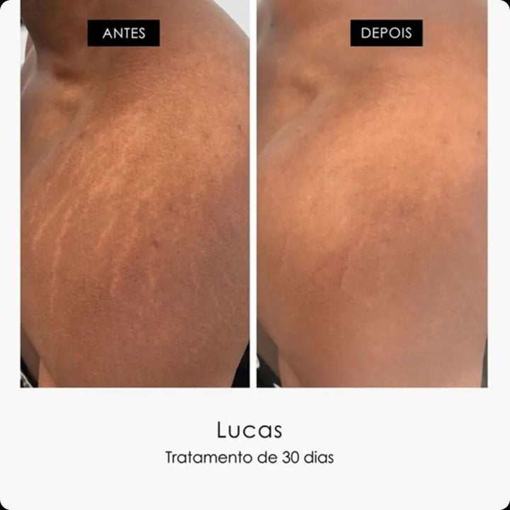 SkinRepair® - Paga 1 y lleva 2 🎁