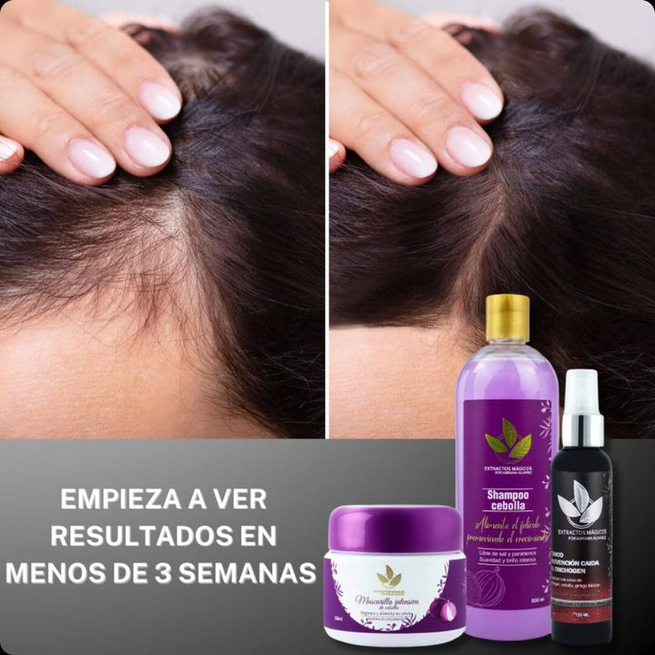 HairVitality™ - KIT X 3 TÓNICO, + CHAMPÚ + MASCARILLA 🎁