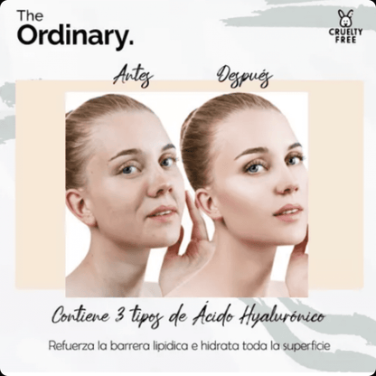 The Ordinary HydraBoost HA Serum™ – ¡Hidratación profunda!