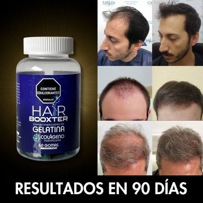 Hair Booxter™  Tratamiento Natural  Con Registro INVIMA