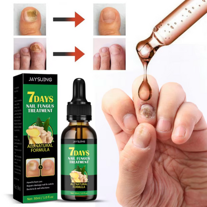 ClearNails® - Uñas Saludables en 7 Días