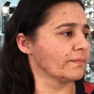 BEAUTY CREAM con Protección SPF 40 + Ácido Hialurónico