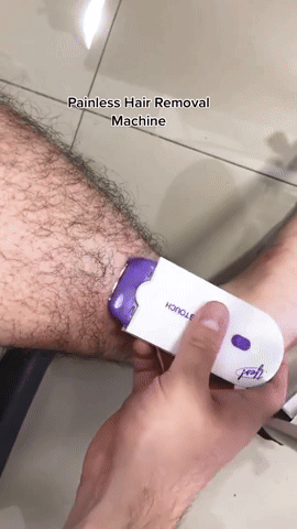 🔥 SmoothSkin™ - Depiladora Láser Sin Dolor para una Piel Perfecta 🔥